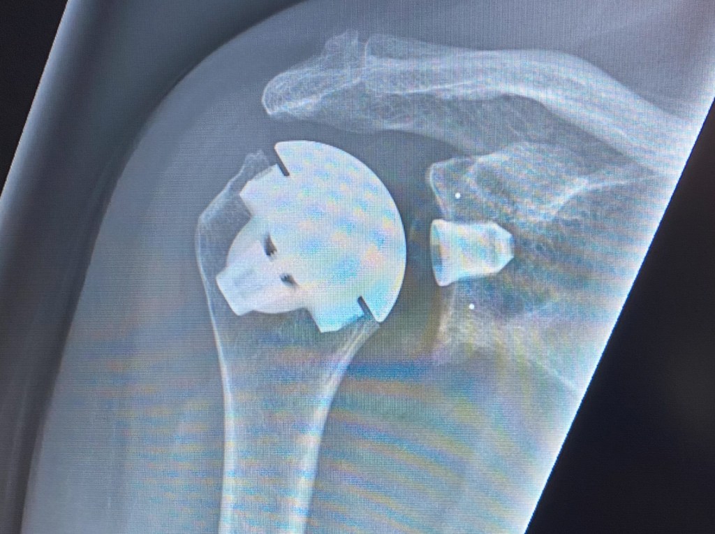 Att börja på ny&nbsp;kula…